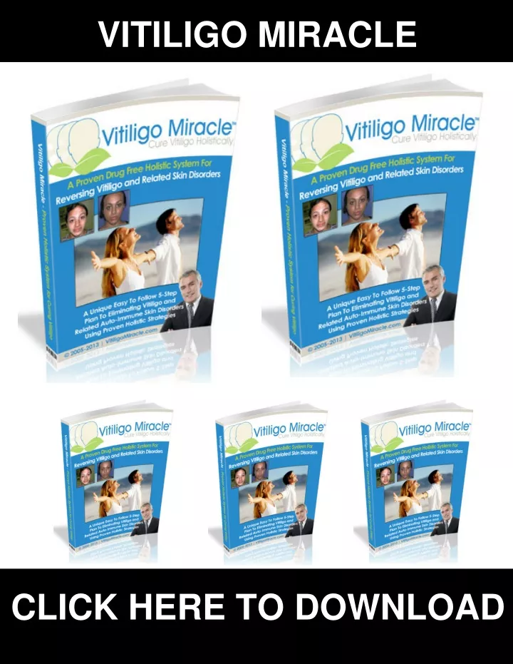 vitiligo miracle