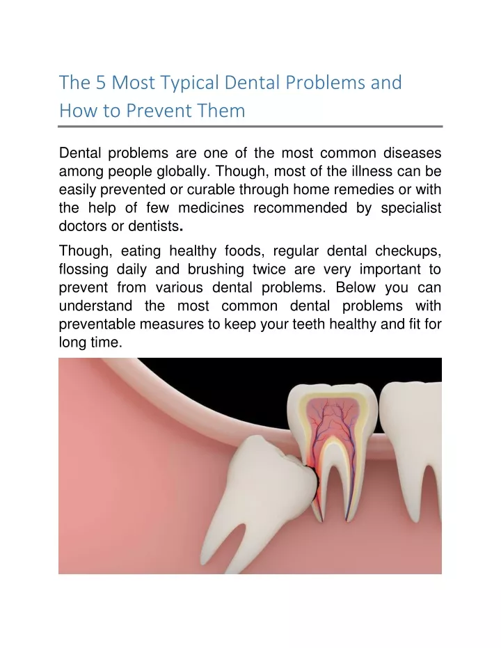 the 5 most typical dental problems
