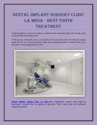 Dental Implant Surgery Clinic La Mesa - Best Tooth Treatment