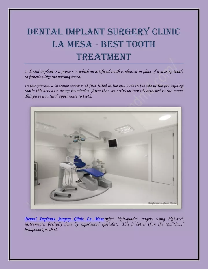 dental implant surgery clinic la mesa best tooth