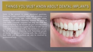 Things you must know about dental implants.