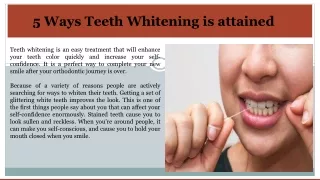 5 Ways Teeth Whitening is attained