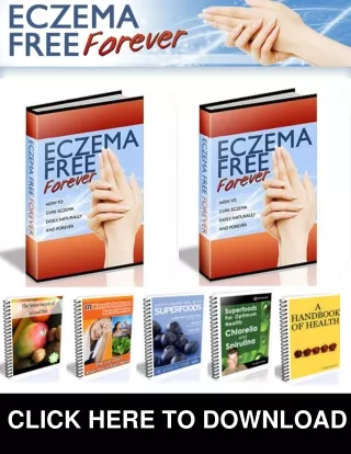 Eczema Free Forever PDF, eBook by Rachel Anderson