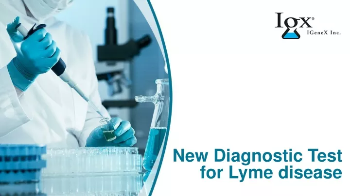 new diagnostic test for lyme disease