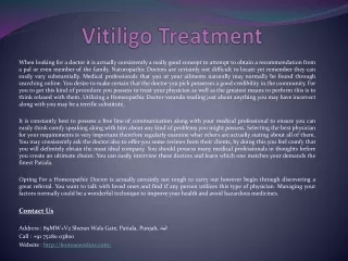 vitiligo treatment
