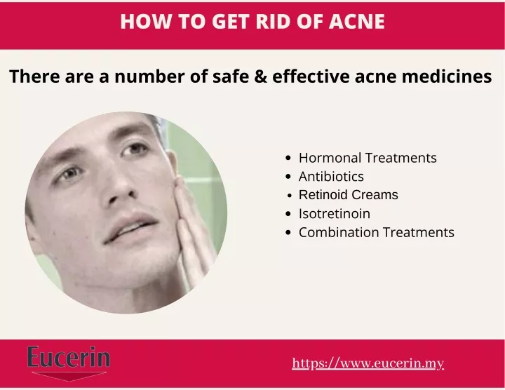 how to get rid of acne