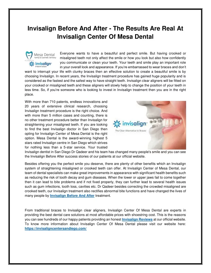 invisalign before and after the results are real