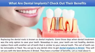 What Are Dental Implants? Check Out Their Benefits