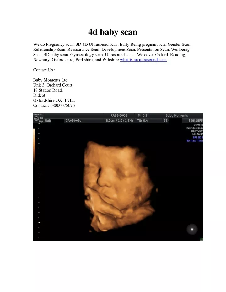 4d baby scan