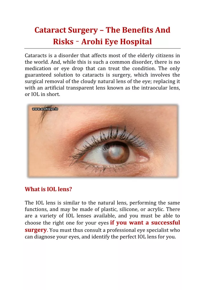 cataract surgery the benefits and risks arohi