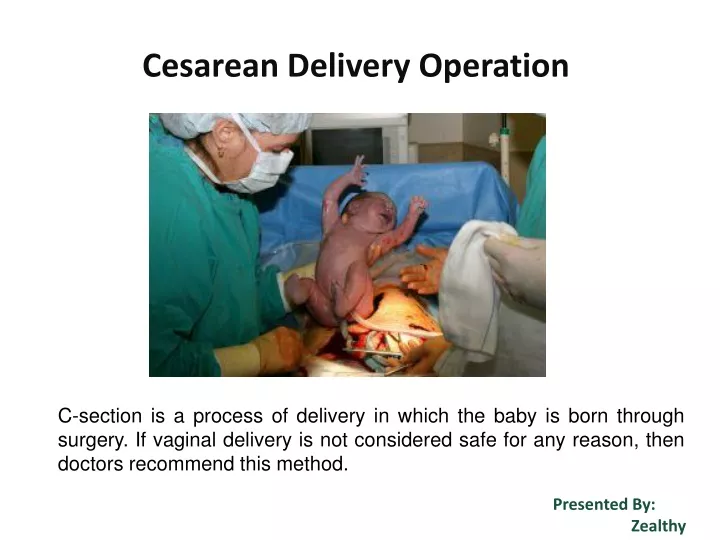 cesarean delivery operation