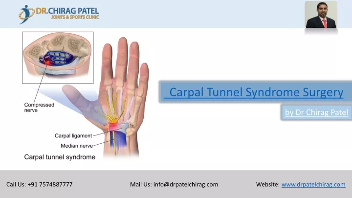 carpal tunnel syndrome surgery