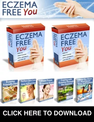 Eczema Free You PDF, eBook by Rachel Anderson