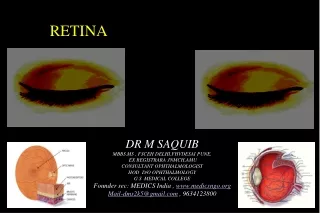 RETINA