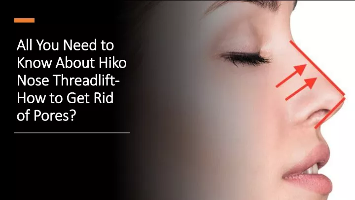 all you need to know about hiko nose threadlift how to get rid of pores