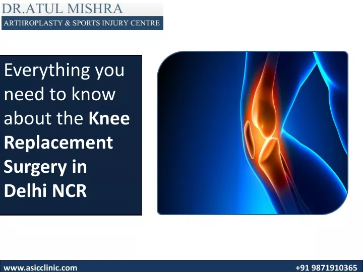 Ppt - Best Knee Replacement Surgery In Delhi Ncr, Total Knee Surgeon 