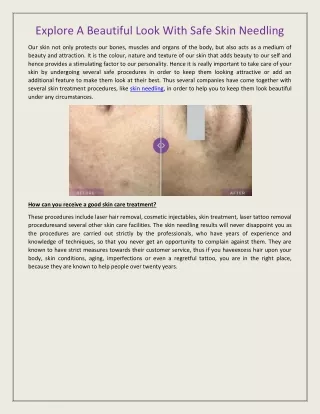 explore a beautiful look with safe skin needling