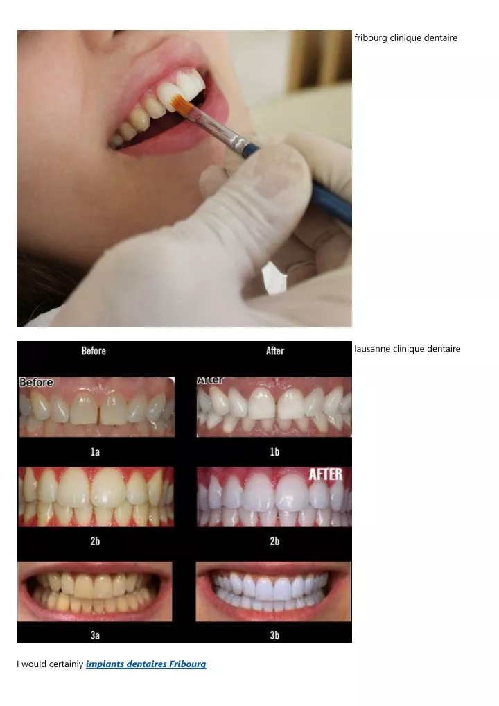 fribourg clinique dentaire