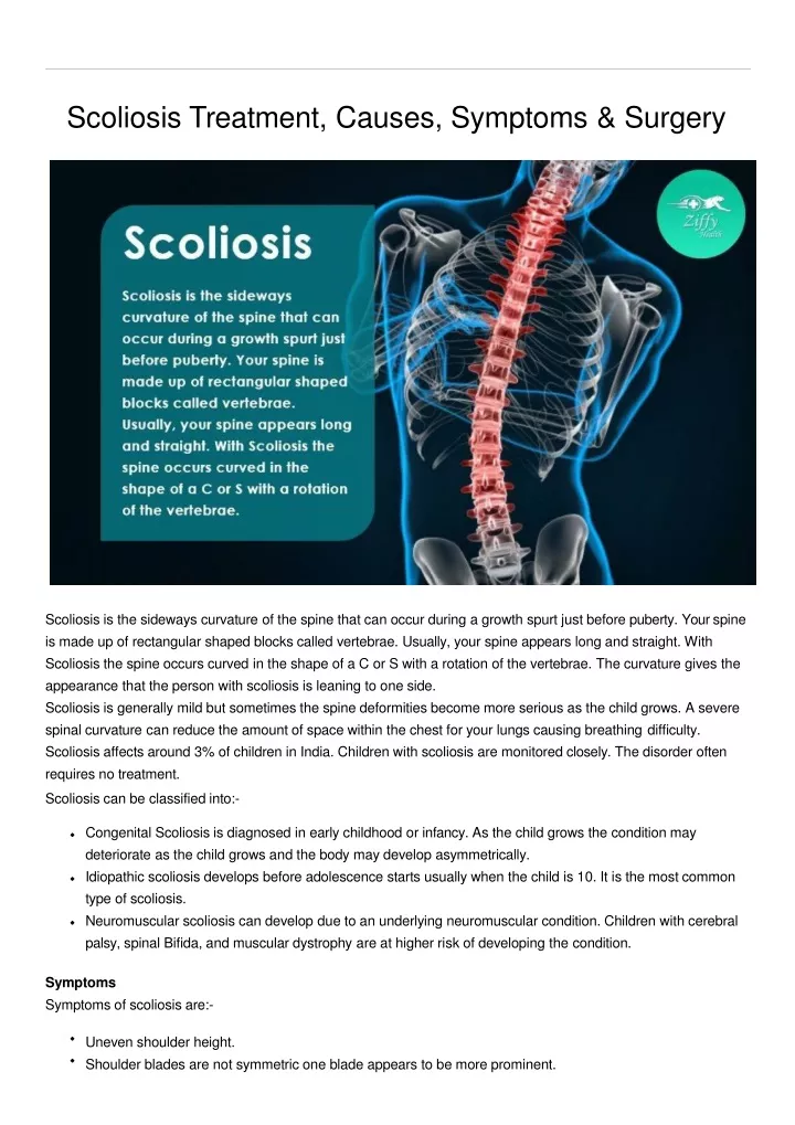 scoliosis treatment causes symptoms surgery