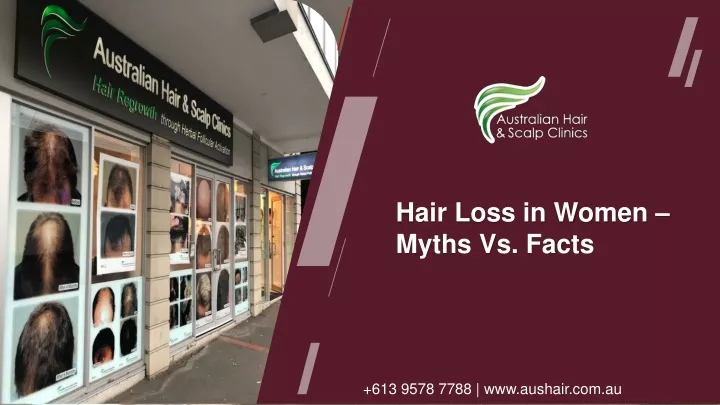 hair loss in women myths vs facts
