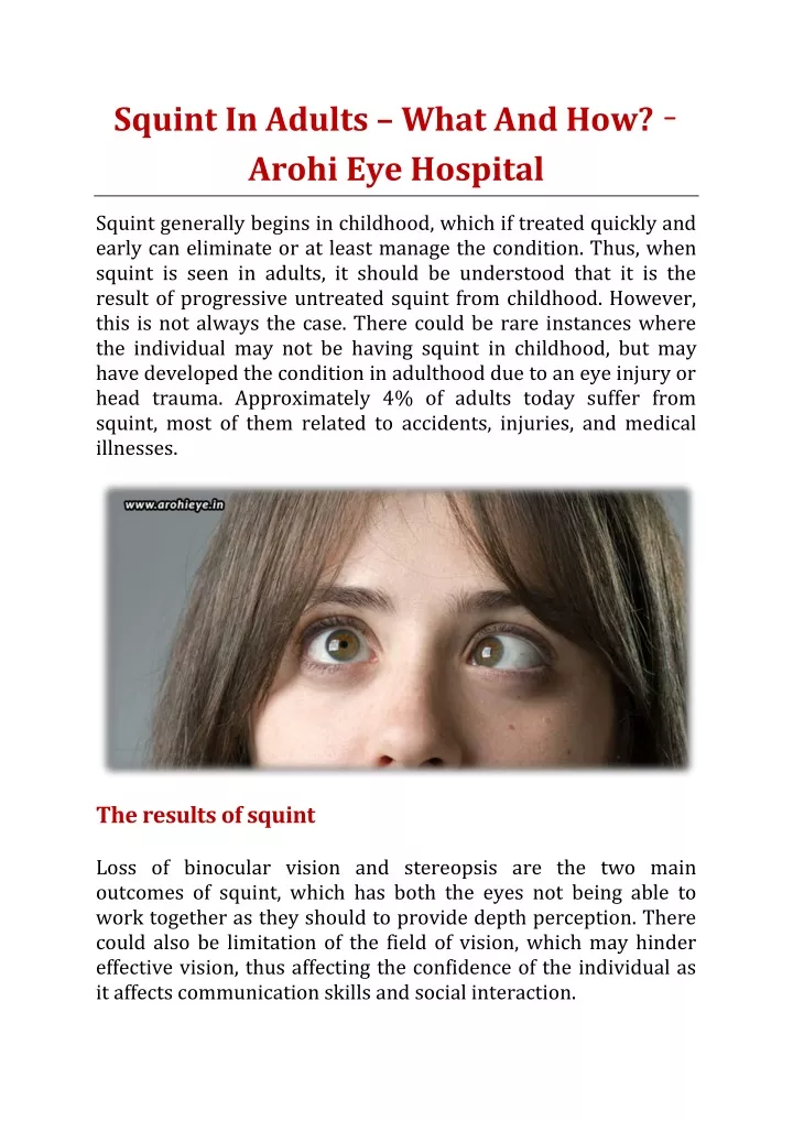 squint in adults what and how arohi eye hospital