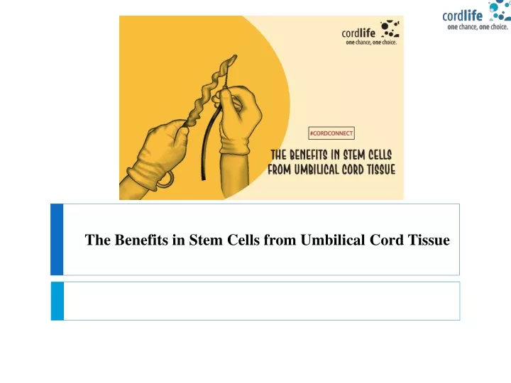 the benefits in stem cells from umbilical cord tissue