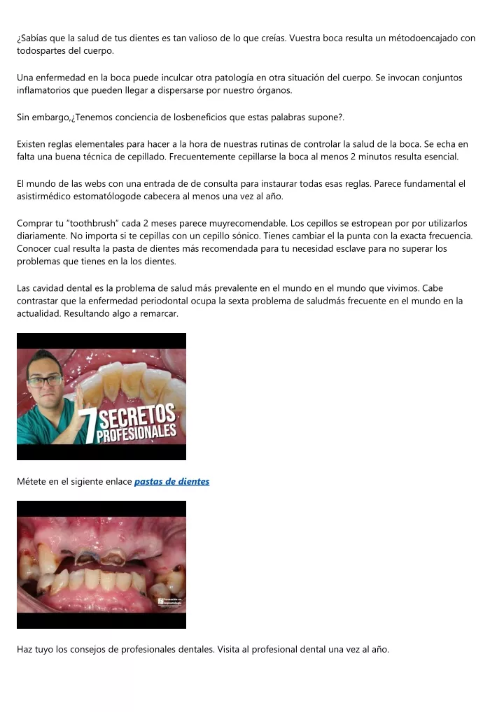 sab as que la salud de tus dientes es tan valioso