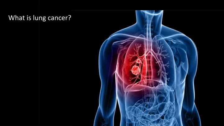 what is lung cancer