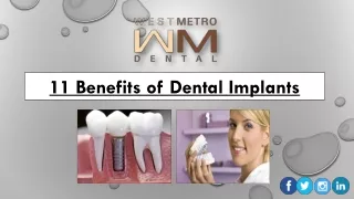 11 Benefits of Dental Implants