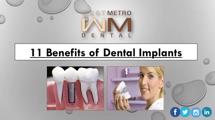 11 benefits of dental implants