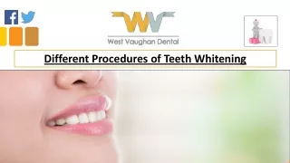 different procedures of teeth whitening