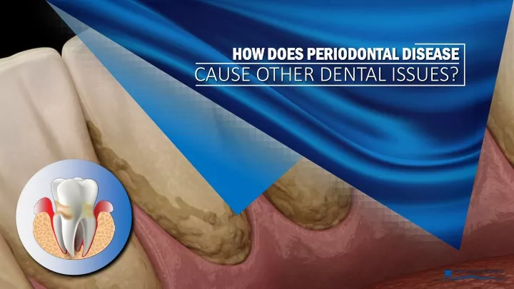 how does periodontal disease cause other dental