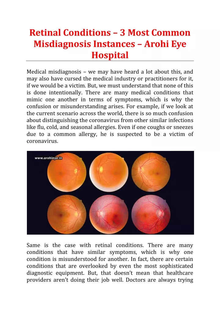 retinal conditions 3 most common misdiagnosis