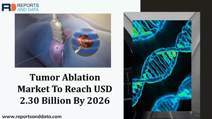 tumor ablation market to reach usd 2 30 billion