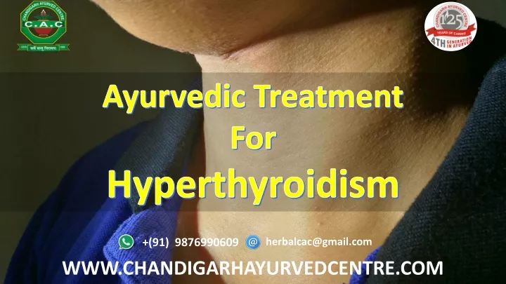 ayurvedic treatment for hyperthyroidism