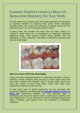 Cosmetic Dentist Crowns La Mesa CA – Restorative Dentistry For Your Teeth