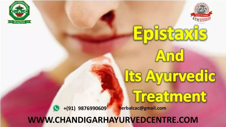 epistaxis and its ayurvedic treatment