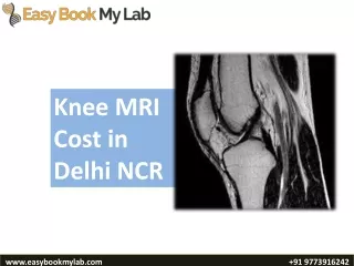 Best MRI scan centre in Delhi | Mri scan cost in Delhi, 50% discount