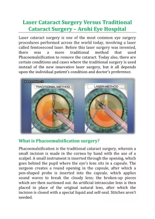 Laser Cataract Surgery Versus Traditional Cataract Surgery - Arohi Eye Hospital