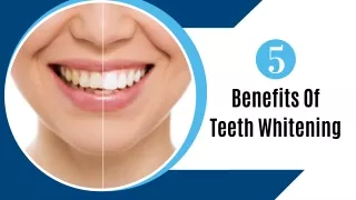 Ppt Benefits Of Professional Teeth Whitening Powerpoint Presentation Id