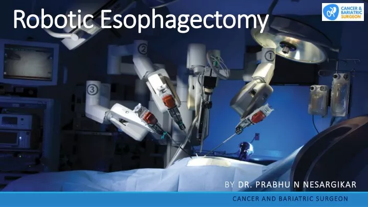 robotic esophagectomy
