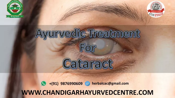 ayurvedic treatment for cataract