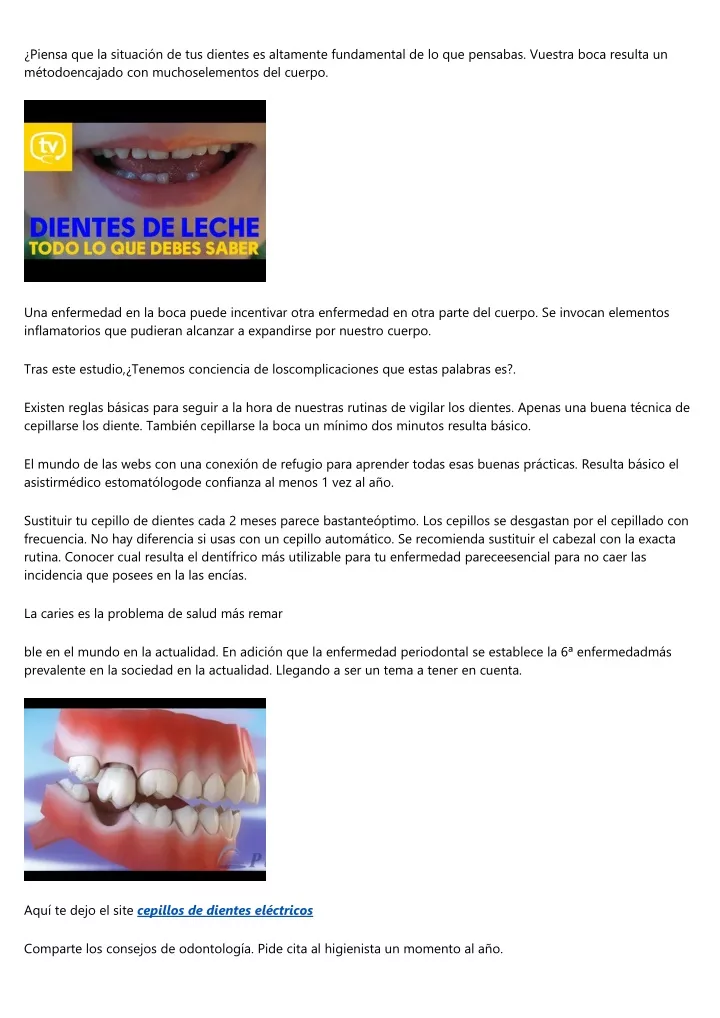 piensa que la situaci n de tus dientes