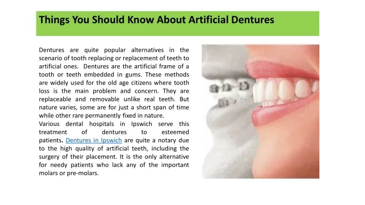 things you should know about artificial dentures