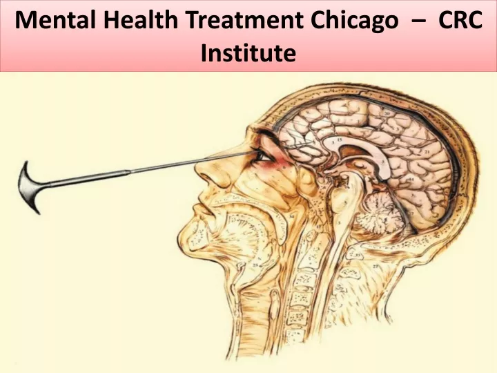 mental health treatment chicago crc institute