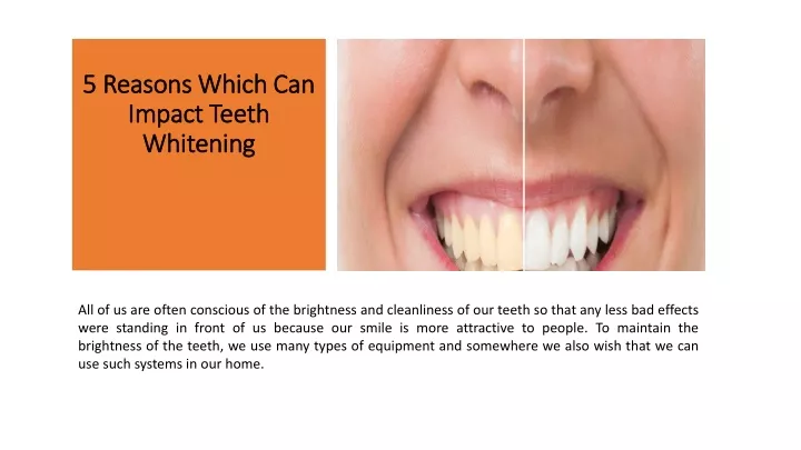 5 reasons which can impact teeth whitening