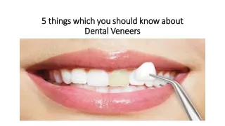 5 things which you should know about Dental Veneers