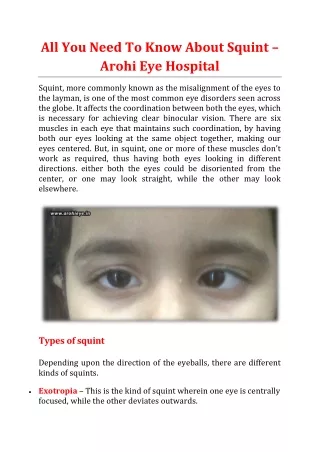 All You Need To Know About Squint - Arohi Eye Hospital