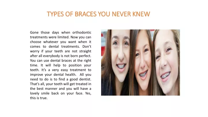 types of braces you never knew