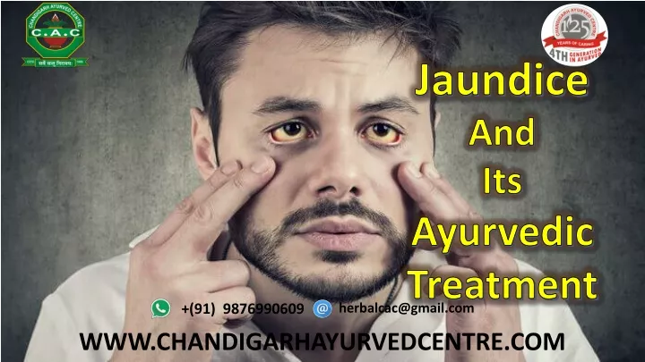 jaundice and its ayurvedic treatment